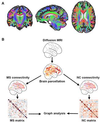 Frontiers | Structural And Functional Connectivity Substrates Of ...